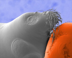 Dr Rok Kostanjsek winning image from the RMS International Micrograph Competition
